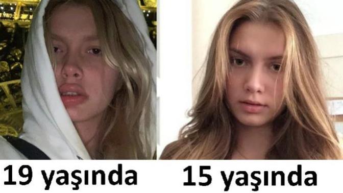 Aleyna Tilki estetiğin sınırlarını aştı mı sizce?
