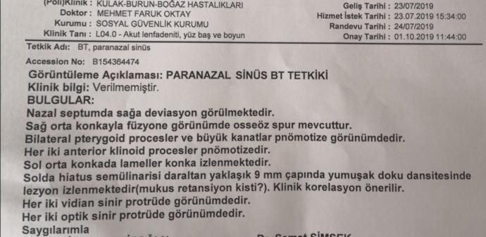 Burun Tomografi Çekildim Sonucumda Ne sorun var yazıyor?