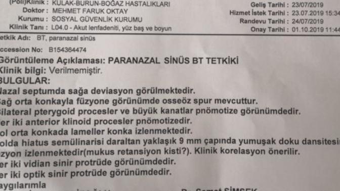 Burun Tomografi Çekildim Sonucumda Ne sorun var yazıyor?
