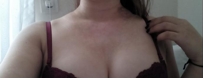 Erkekler, Sizce vitiligo itici mi?