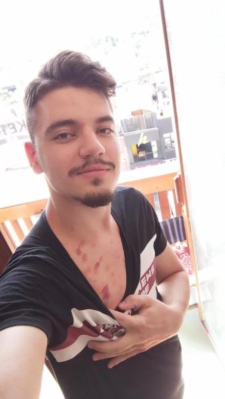 Erkekler, boynunuzu morartana kadar emen kız tahrik eder mi?
