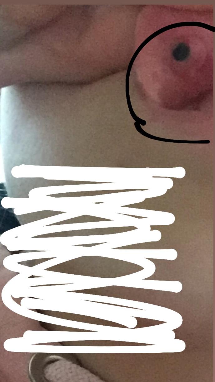 Dudak piercing yaptırdım 2 ay falan oldu böyle bişey oldu çıkmıyoda piercing acı falan yok ne yapmam lazım?