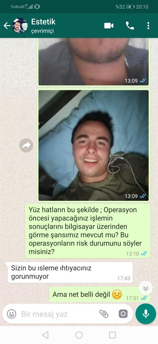 Çene ve elmacık kemiği belirginleştirme ameliyatı yaptırmak istiyorum. Yüz hatlarımın bu ameliyata ihtiyacı var mıdır?