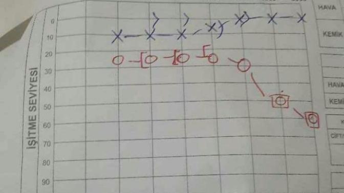 Arkadaşlar hiç kulağı için enjeksiyon (iğne) olan var mi?