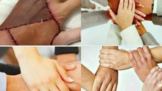 Ağaç mısın yaprakmi?