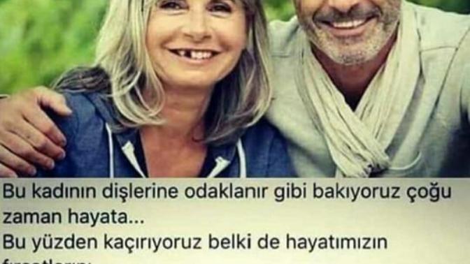 Her güzelin bir kusuru var mıdır?