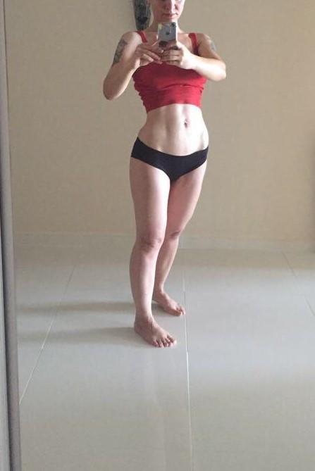 Liposuction fiyatları bilen ve liposuction yaptıranların yorumları nedir?