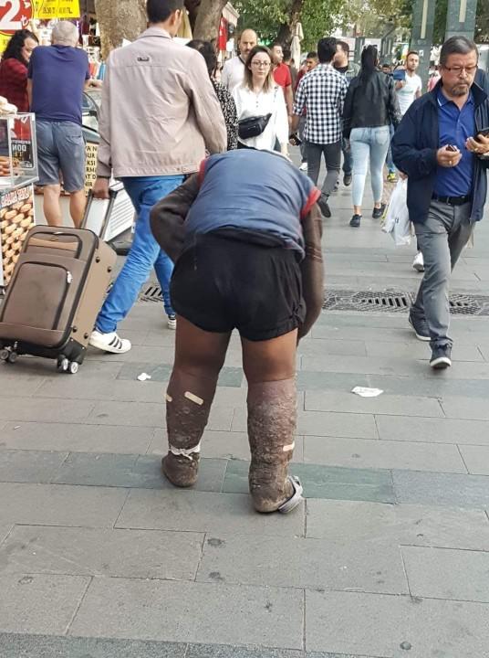Antalyadaki dilenci adamın yaptıkları hakkında ne düşünüyorsunuz?