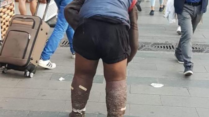 Antalyadaki dilenci adamın yaptıkları hakkında ne düşünüyorsunuz?