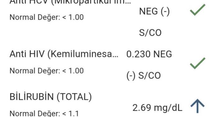 Merhaba tahlil sonucu yorumlayabılecek olan kişiler baksın?