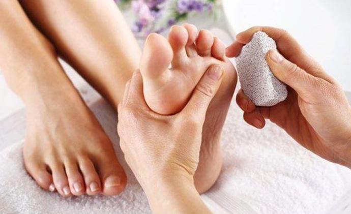 Ayaktaki nasır nasıl geçer, denenmiş doğal yöntemler var mı?