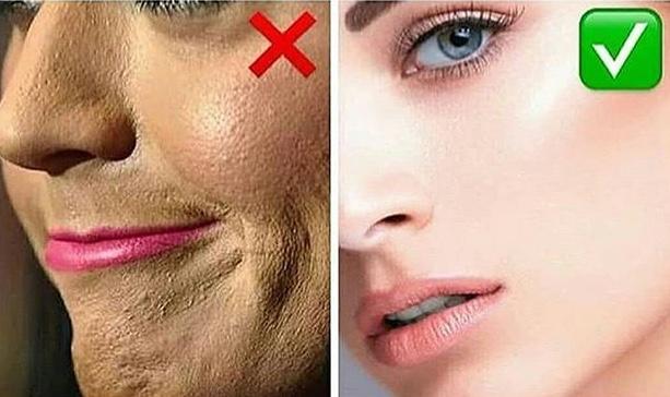 Makyaj bazı nedir, fondötenin pul pul olmasını nasıl engellerim?