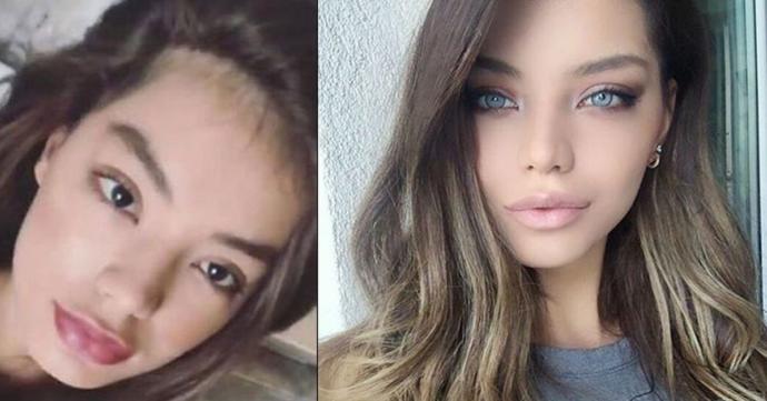 Göz rengi değiştirme ameliyatı sizce tehlikeli mi?