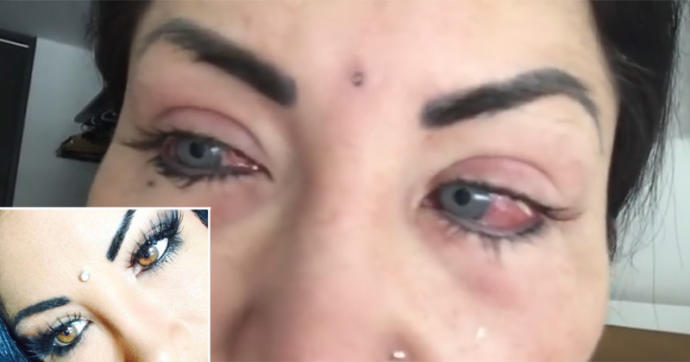 Göz rengi değiştirme ameliyatı sizce tehlikeli mi?