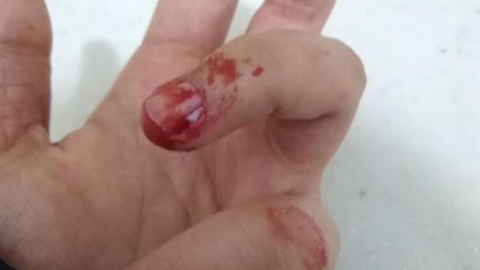 Kedi köpek ısırığı hakkında bilgi sahibi olan var mı aranızda?