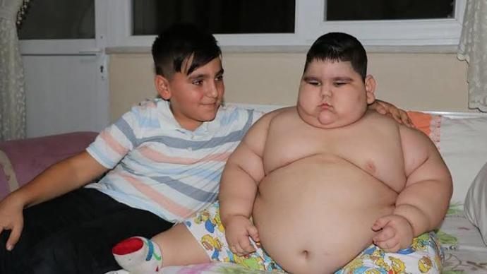 4 yaşında tam 70 kilo Devletten yardım bekliyorlar O yardım gelecek mi?