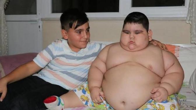 4 yaşında tam 70 kilo ''Devletten yardım bekliyorlar'' O yardım gelecek mi?