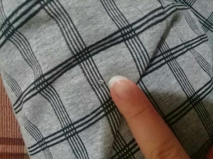 Tırnaklarım uzayınca bükülüyor neden olabilir?