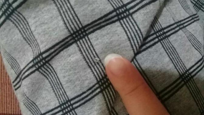 Tırnaklarım uzayınca bükülüyor neden olabilir?