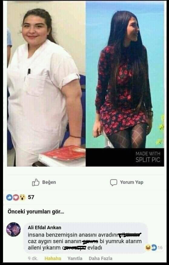 Çevrenizdeki şişman tanıdıklarınız zayıflayınca nasıl tepki veriyorsunuz?