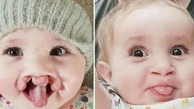 Her estetik güzellik getirirmi sizce?