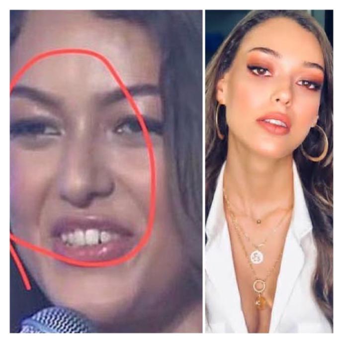 Bende hiç estetik yok! diyen Dilan Deniz ve Özge Ulusoy’a ne demek istersin KScan?