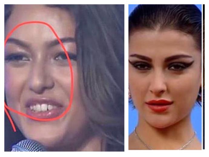 Bende hiç estetik yok! diyen Dilan Deniz ve Özge Ulusoy’a ne demek istersin KScan?