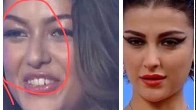 Bende hiç estetik yok! diyen Dilan Deniz ve Özge Ulusoy’a ne demek istersin KScan?