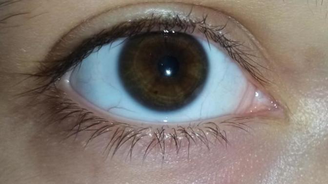 5 gündür biyokinezi yapıyorum gözlerim kahverengiydi ama dışı bence yeşermeye başladı çok az  bir  siz de baksanız?