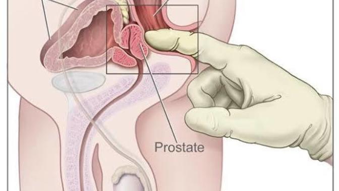 Heteroseksüel bir erkek prostat orgazmı olur mu? Kadından kendisine arkadan dokunmasını, okşamasını ister mi?