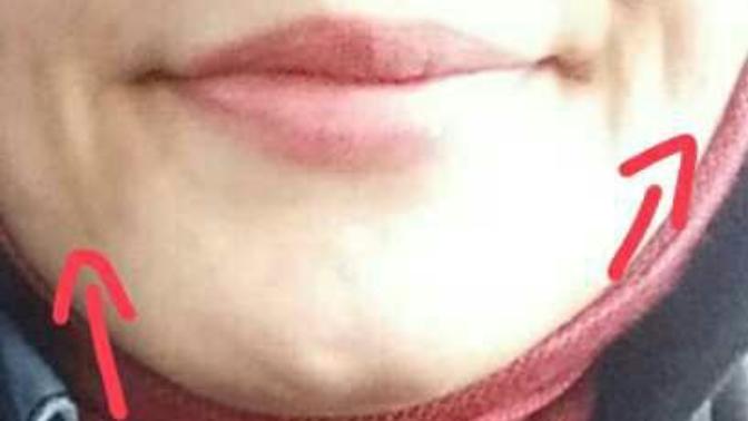 Bunlar mimik çizgisi mi yoksa yaşlılık çizgisi mi?