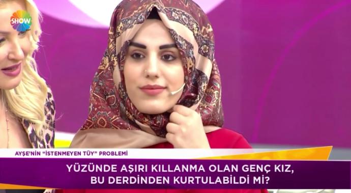 Eşinizin yüzünde kıllar olsa ne yapardınız?