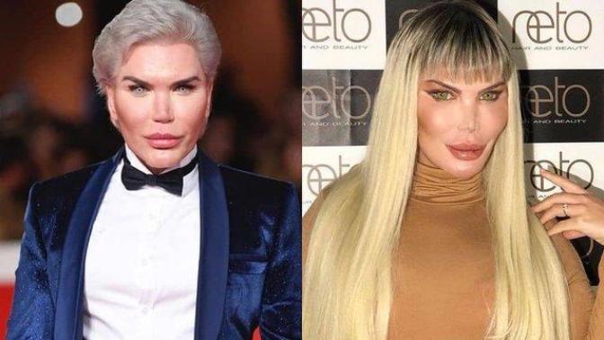 Ken bebek Rodrigo Alves ameliyatla kadın oldu! Alves'in kadın halini beğendiniz mi?