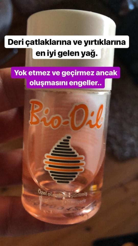 Çatlak sorunu yaşıyorum ağlicam?