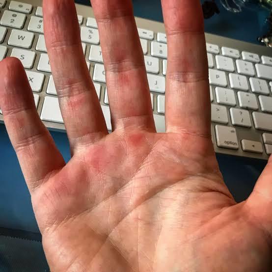 Sevgilinizin eli spor yaptığı için böyle olsa iğrenir miydiniz?