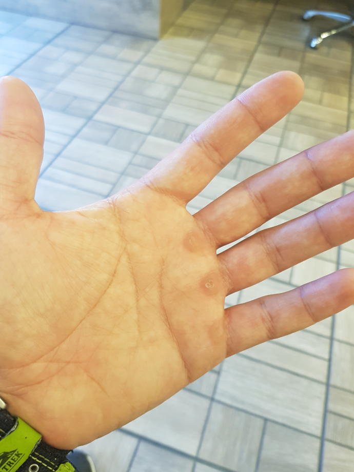 Sevgilinizin eli spor yaptığı için böyle olsa iğrenir miydiniz?
