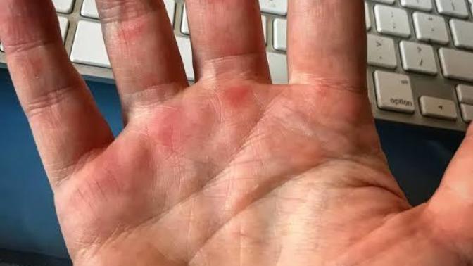 Sevgilinizin eli spor yaptığı için böyle olsa iğrenir miydiniz?