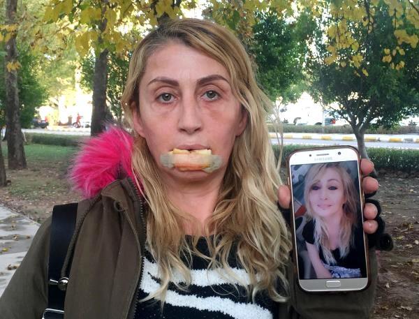 Yeni ve eski hali