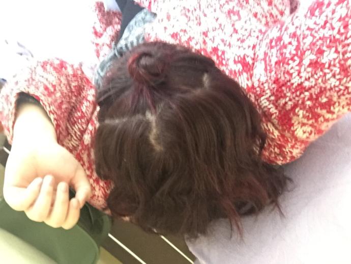 Saçım çok açılmış mı? Normal mi?