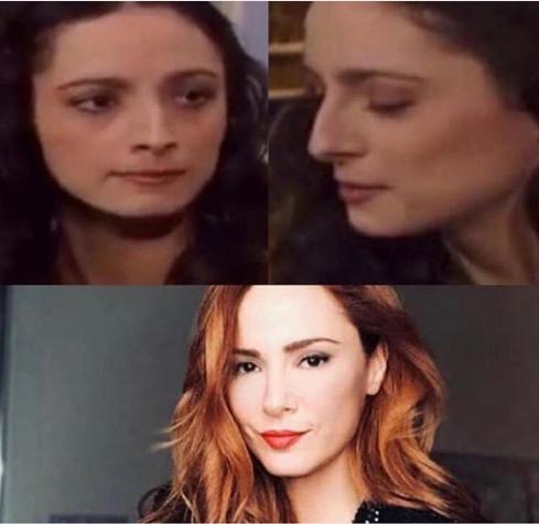 Estetik yaptıran oyuncular, estetiksiz halleriyle bu kadar popülariteye ulaşabilirler miydi?