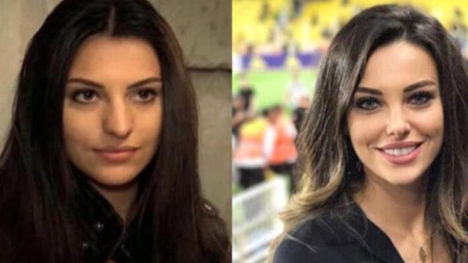 Estetik yaptıran oyuncular, estetiksiz halleriyle bu kadar popülariteye ulaşabilirler miydi?
