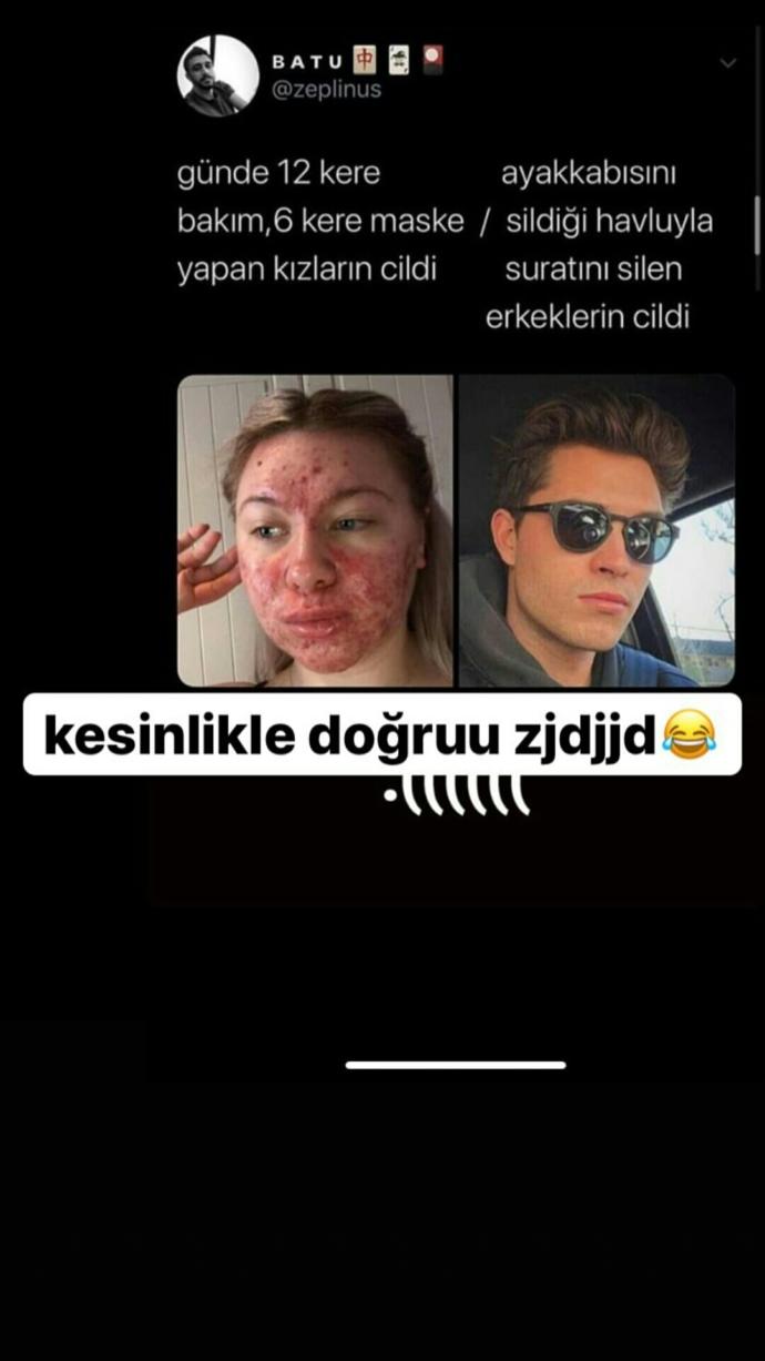 Erkeklerin cildi neden bizden daha güzel acaba?