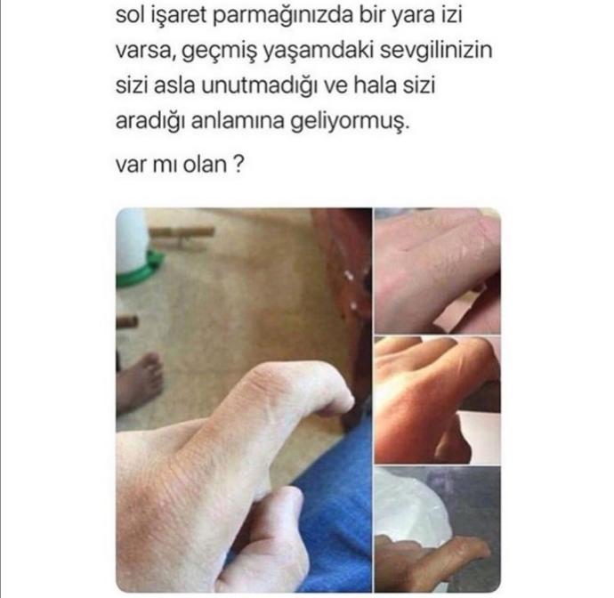 Sol işaret parmaginizda iz varmi?