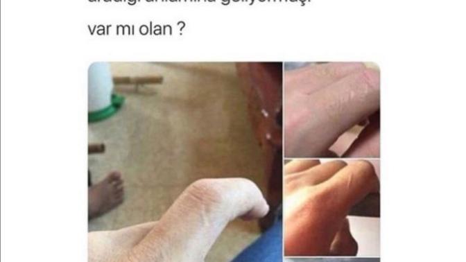 Sol işaret parmaginizda iz varmi?