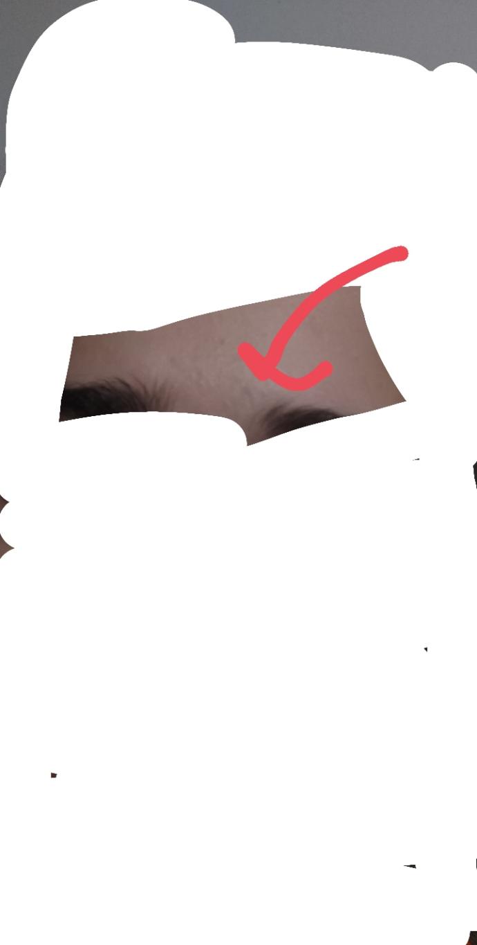 Su çiçeği izi polisliğe engel durum mu?