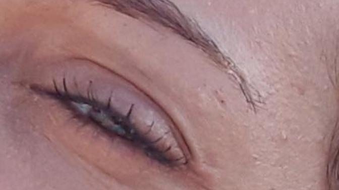 Ten rengim nedir?