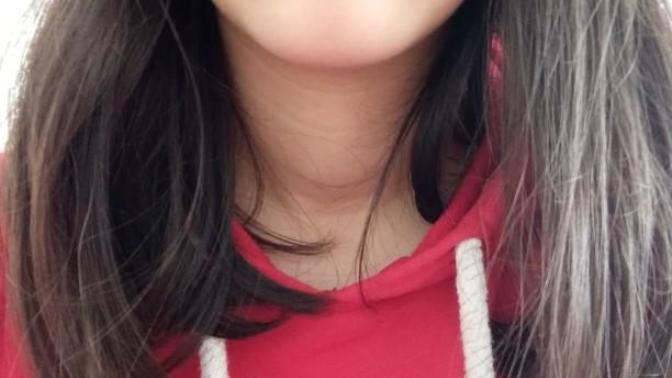 Dişlek miyim? Yardım edin lütfen?