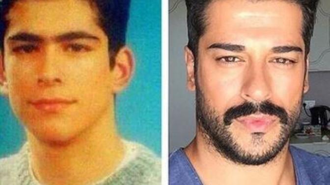 Burak özçivitin eski hali ile yeni hali?
