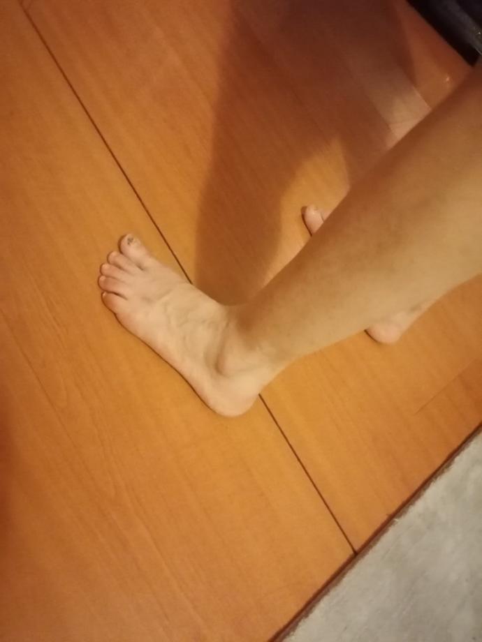 Düz taban mı bu ayak bu kişiyi askere alirlar mi?