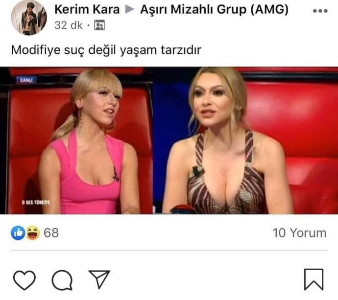 Hadise estetik mi oldu acaba 🤔😒?